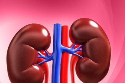 Kidney Transplant